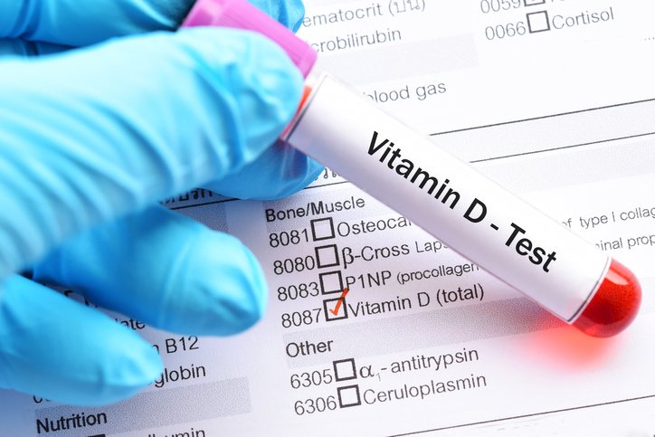 Οι ευεργετικές ιδιότητες της βιταμίνη D! –Γιατι είναι απαραίτητη και που ενισχύει τον οργανισμό;